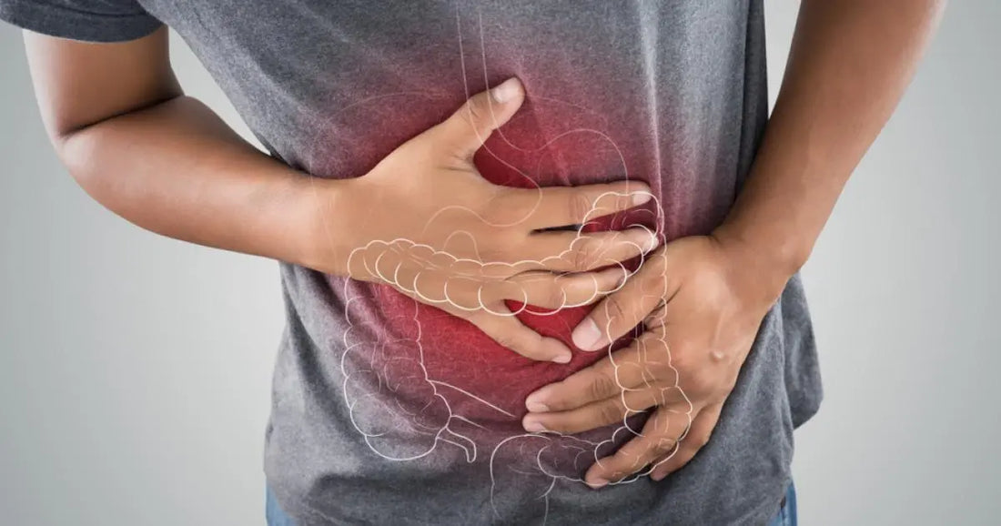 Colon-irritable-inflammation-digestive-et-SIBO-Comprendre-et-soulager-vos-symptômes-naturellement NICE ORGANIC herboristerie bio